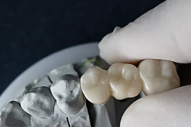 Dental Bridges in Louisville, KY