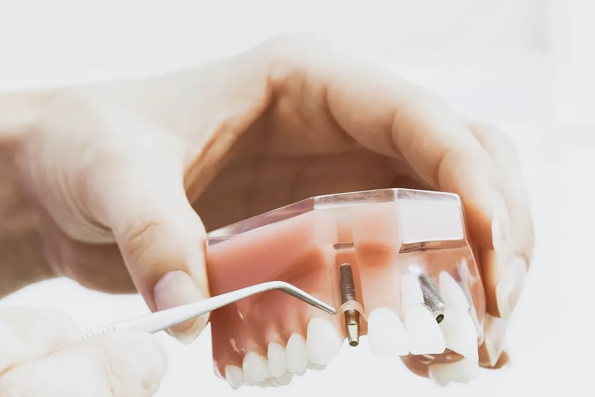 Dental Implants in Louisville, KY