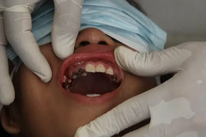 Oral Trauma Treatment in Louisville, KY